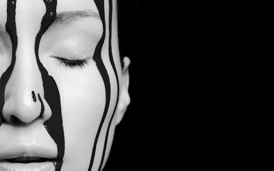 5 conseils pour apprendre à vivre avec le vitiligo